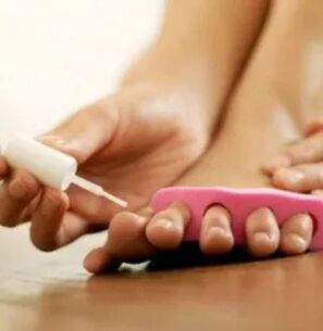 Application de vernis thérapeutique